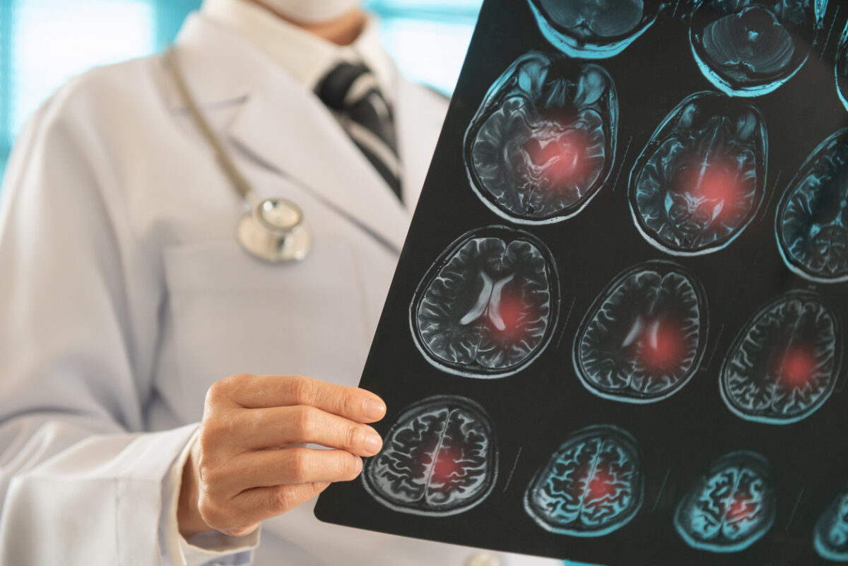 Η Τεχνητή Νοημοσύνη στην υπηρεσία της ιατρικής – Εντυπωσιακά αποτελέσματα στη οφθαλμολογία