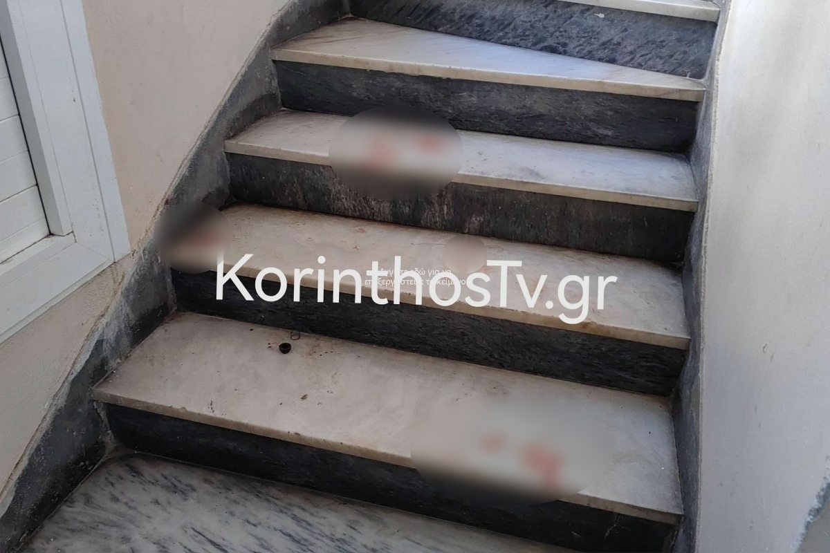 Κόρινθος: 38χρονη δέχτηκε επίθεση από τον πρώην σύντροφό της και τη νυν του – Την χτύπησαν και της έριξαν νέφτι στο πρόσωπο 2 Κόρινθος: 38χρονη δέχτηκε επίθεση από τον πρώην σύντροφό της και τη νυν του – Την χτύπησαν και της έριξαν νέφτι στο πρόσωπο