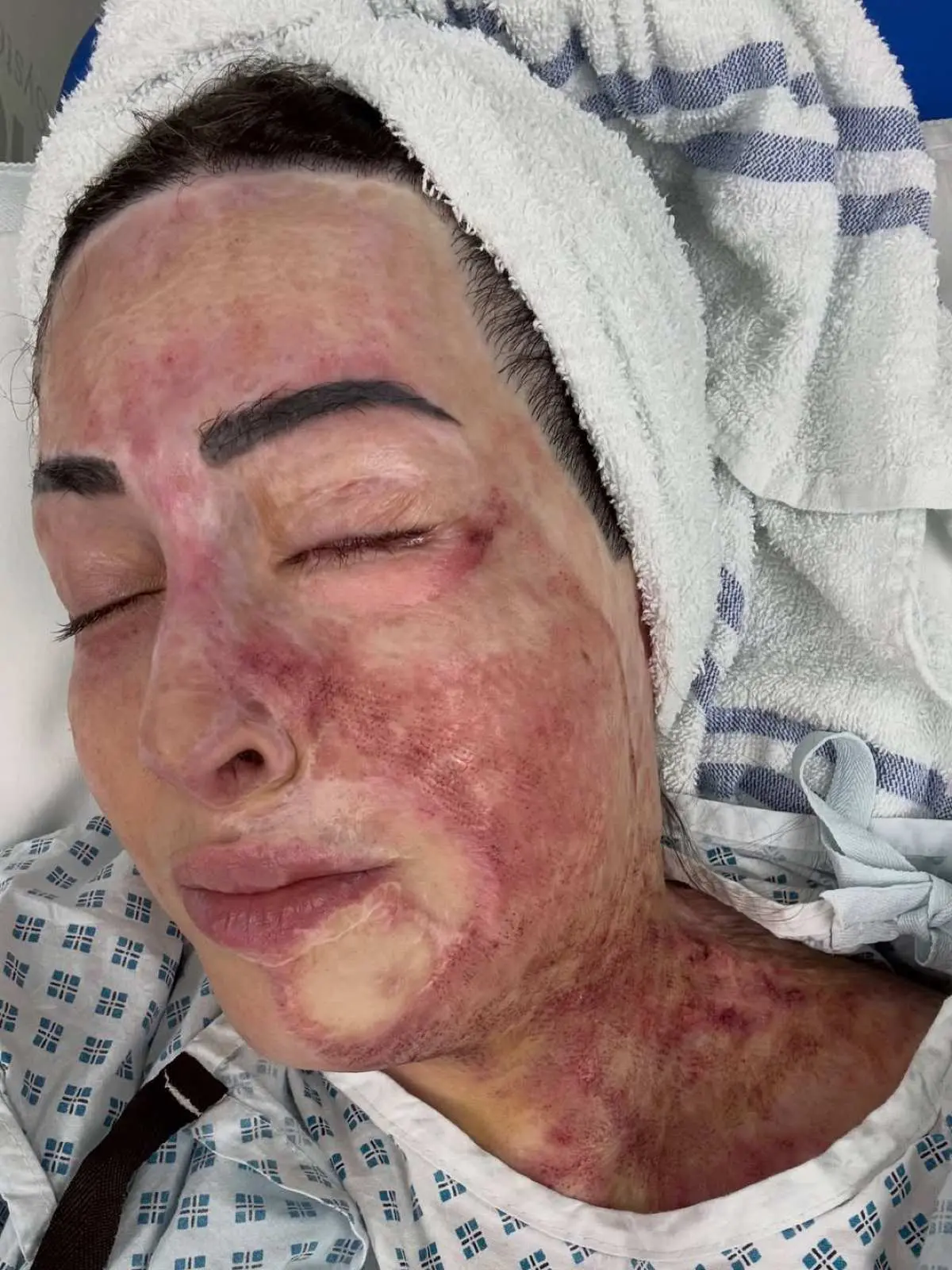 Ιωάννα Παλιοσπύρου: Ακριβές θεραπείες και η είδηση για την αποφυλάκιση της Κακαράντζουλα 2 Παλιοσπύρου σημάδια