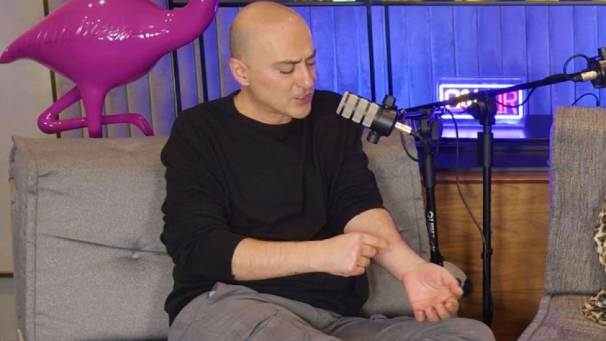 Θανάσης Αλευράς για την ψωρίαση: «Ποτέ δεν έπαψα να την παρακολουθώ, αναρωτιόμουν “γιατί να το πάθω εγώ;”»