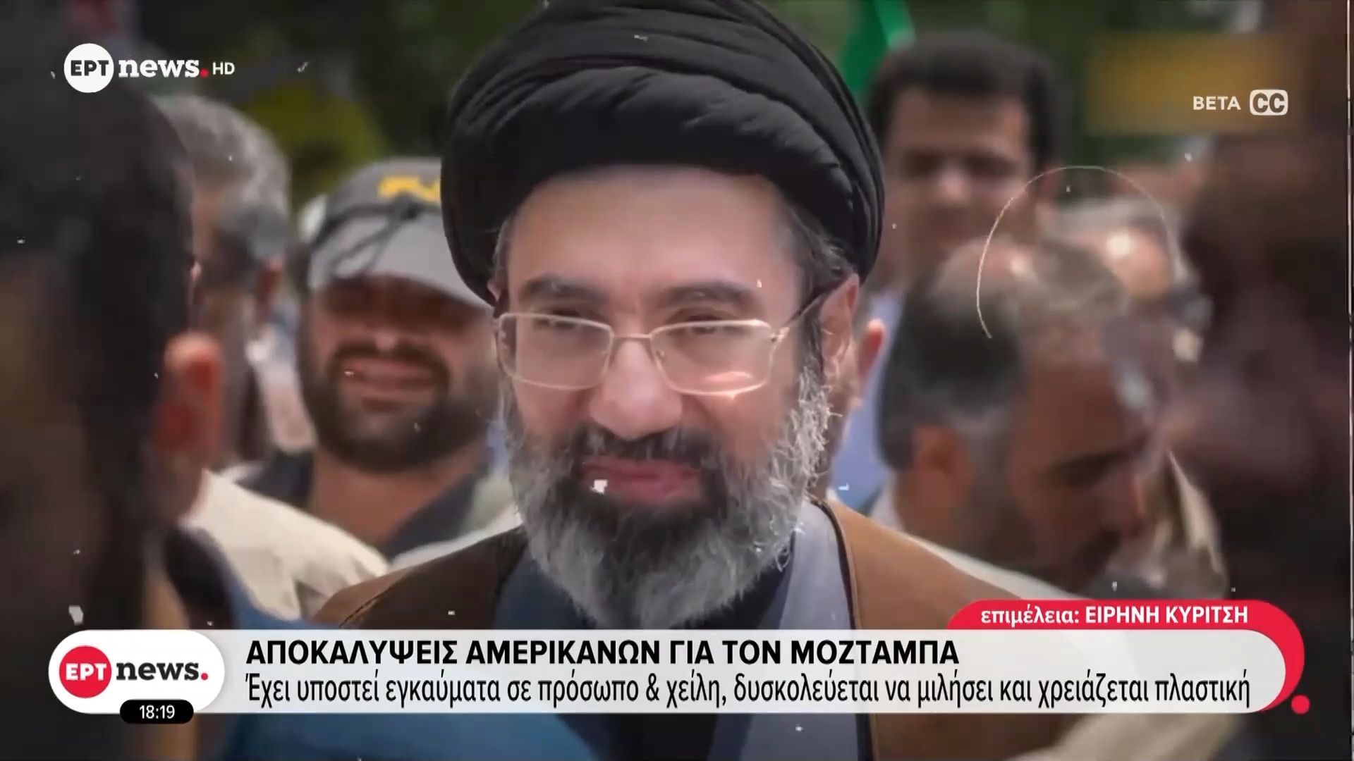 Αποκαλύψεις Αμερικανών για τον Μοζτάμπα – Έχει υποστεί εγκαύματα σε πρόσωπο και χείλη, δυσκολεύεται να μιλήσει και χρειάζεται πλαστική