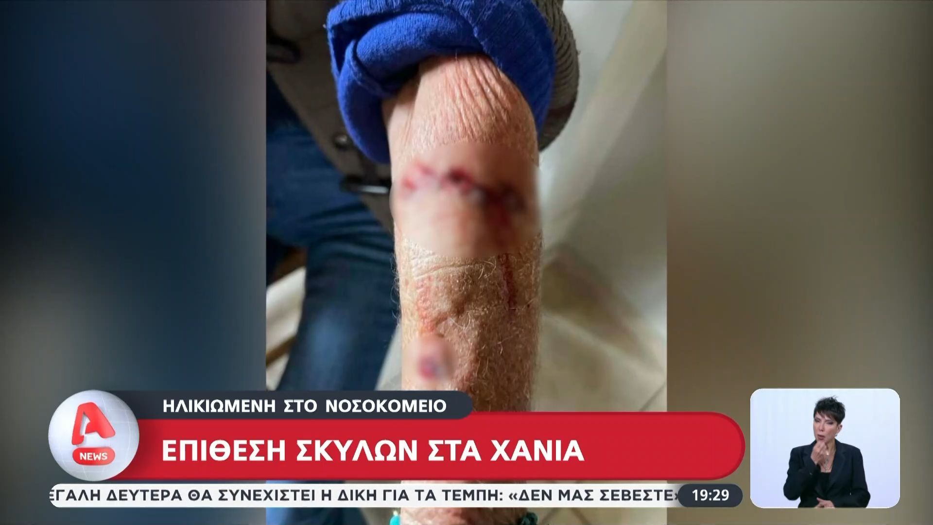 Χανιά: Επίθεση σκύλων σε ηλικιωμένη