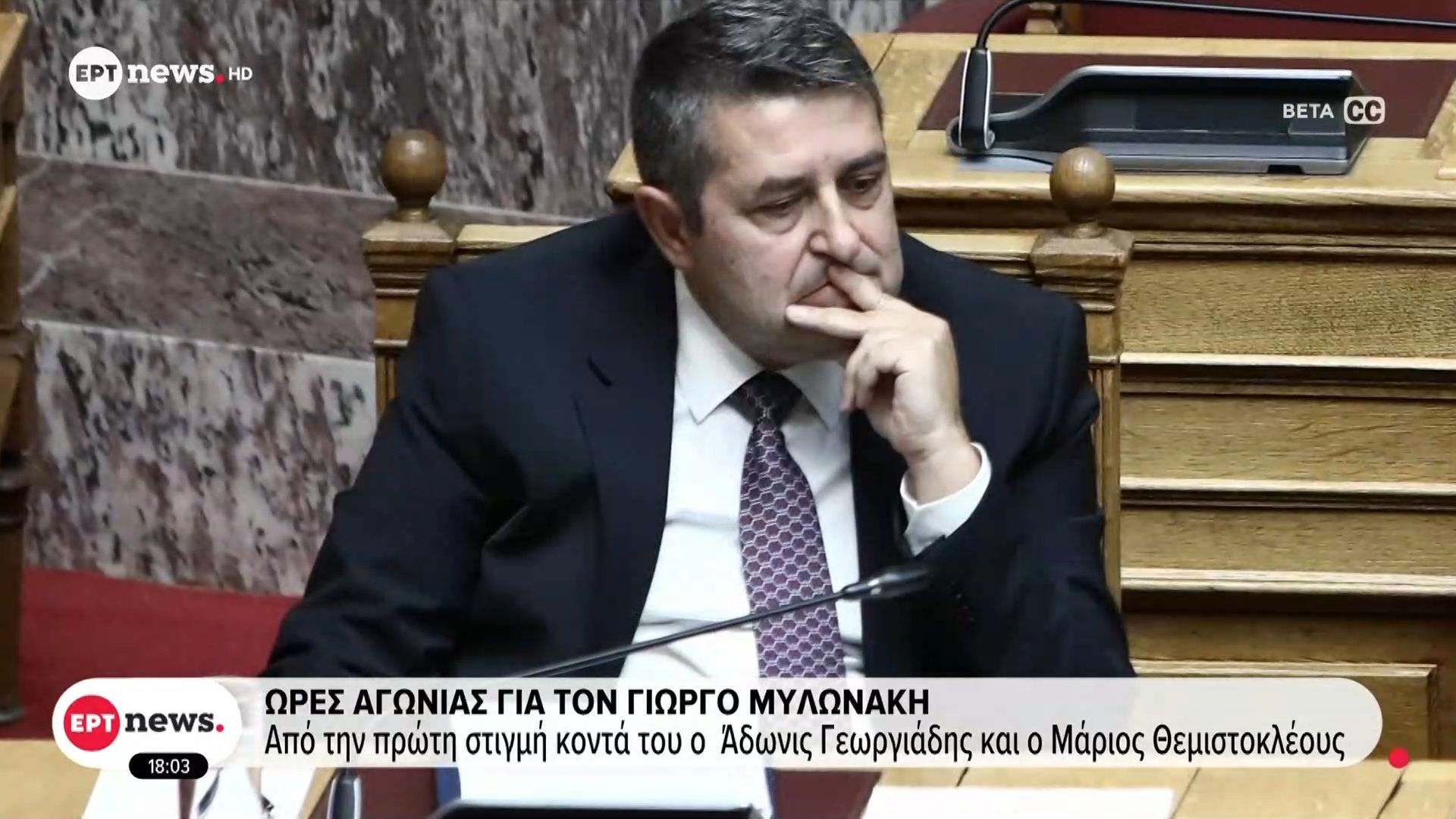 Ώρες αγωνίας για τον Γιώργο Μυλωνάκη – Υπέστη ρήξη εγκεφαλικού ανευρύσματος για το οποίο υποβλήθηκε σε εμβολιασμό