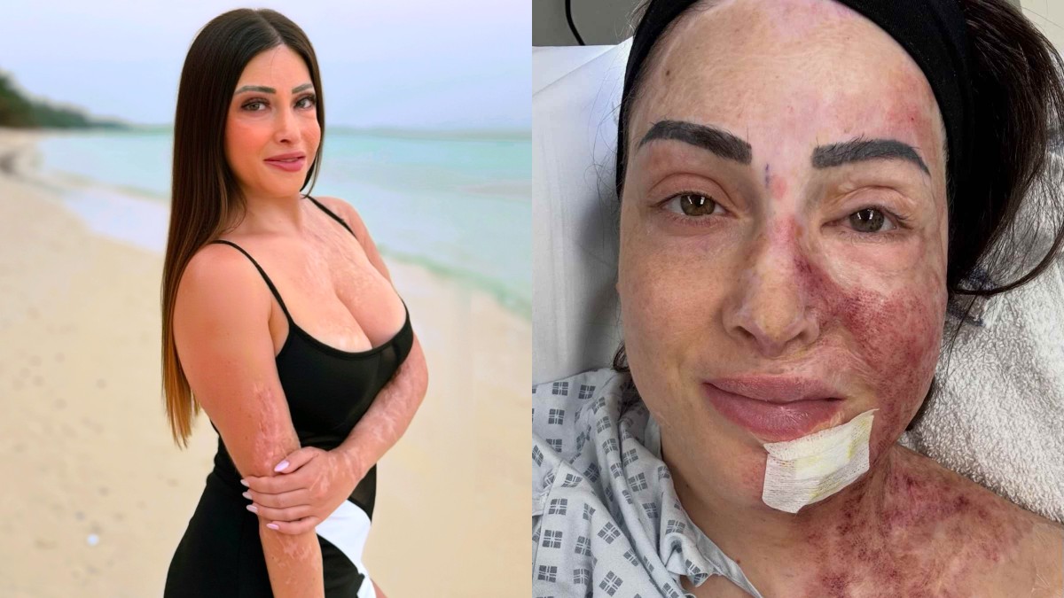 Παλιοσπύρου: «Δεν είναι ευχάριστο, ούτε απλό» – Συγκλονίζει η δημοσίευση για τις καινούριες θεραπείες της στη Βρετανία