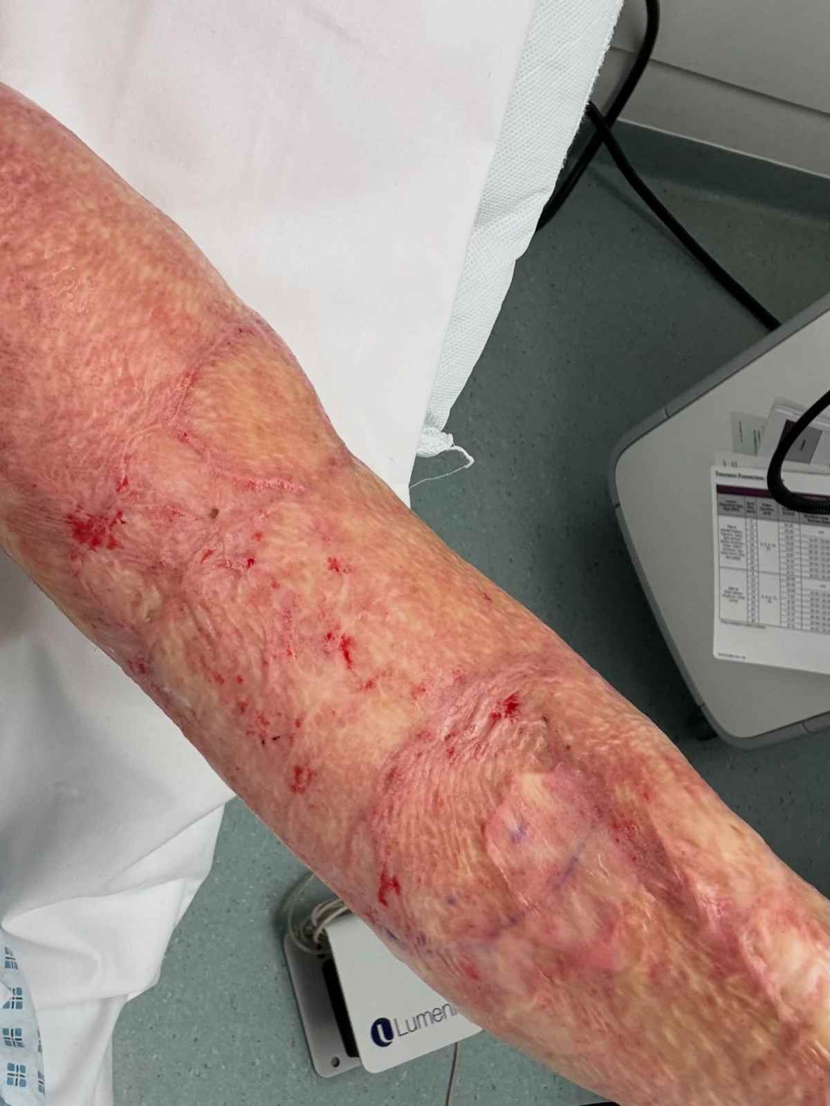 Παλιοσπύρου