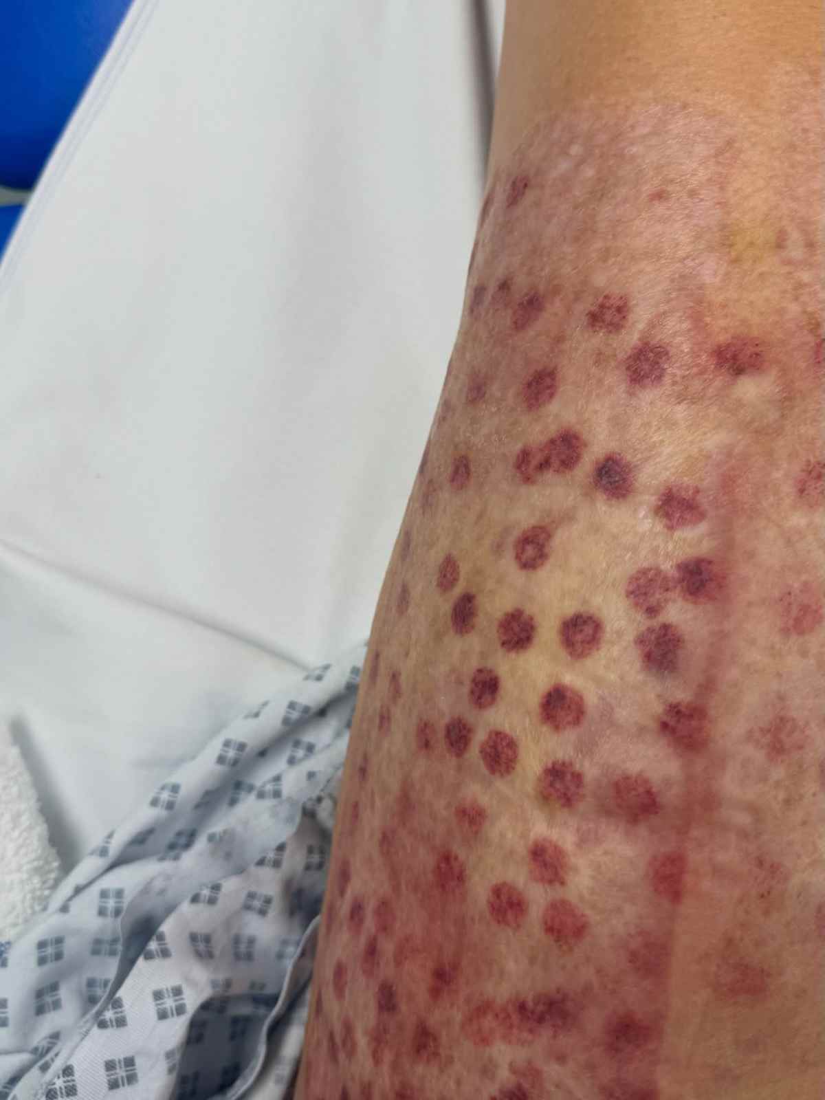 Παλιοσπύρου