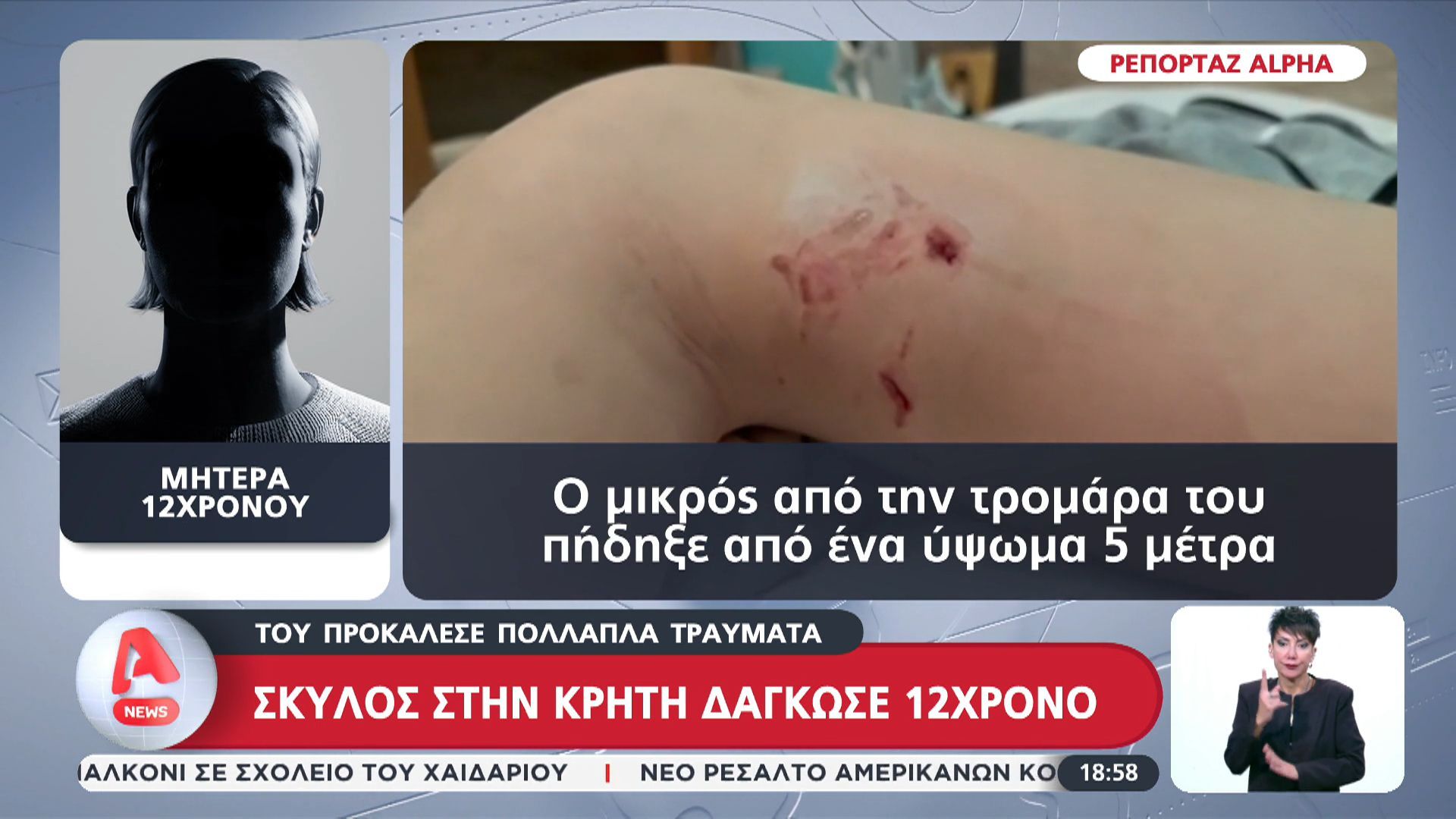 Σκύλος στην Κρήτη δάγκωσε 12χρονο και του προκάλεσε πολλαπλά τραύματα