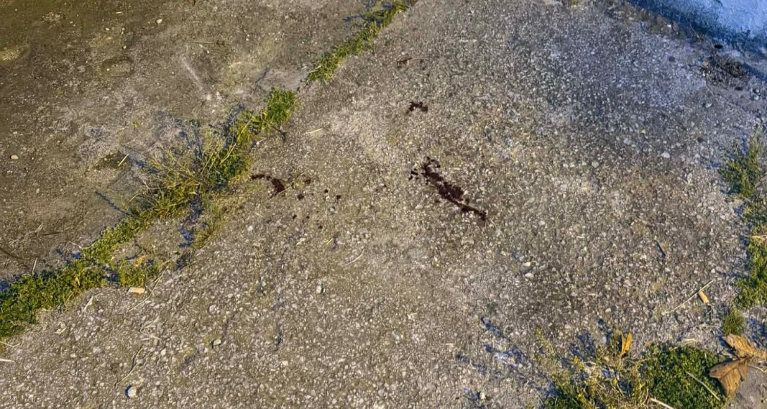 Θεσσαλονίκη: Πυροβολισμός 28χρονου Τούρκου – Είχε οικονομικές διαφορές με τους δράστες