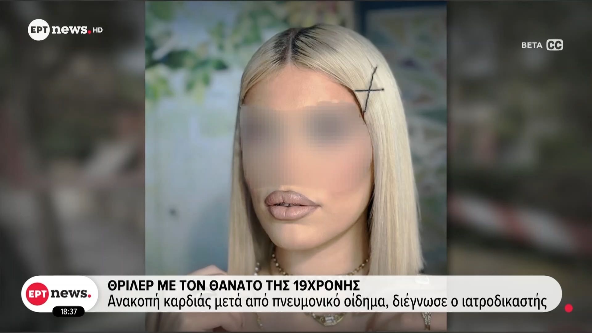 Θρίλερ με τον θάνατο της 19χρονης – Ανακοπή καρδιάς μετά από πνευμονικό οίδημα, διέγνωσε ο ιατροδικαστής