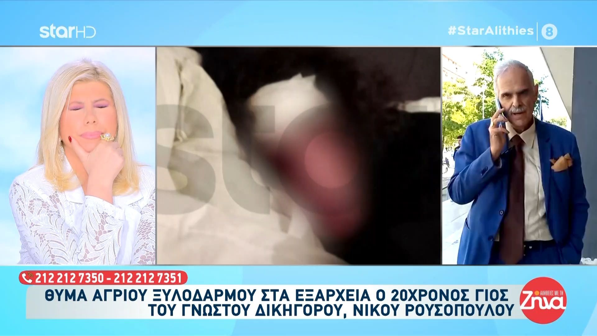 Θύμα άγριου ξυλοδαρμού στα Εξάρχεια ο 20χρονος γιος του γνωστού δικηγόρου, Νίκου Ρουσόπουλου