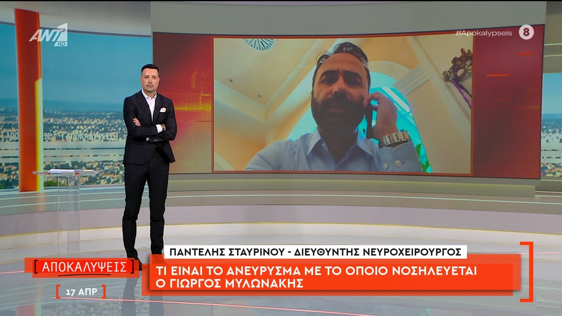 Τι είναι το ανεύρυσμα με το οποίο νοσηλεύεται ο Γιώργος Μυλωνάκης