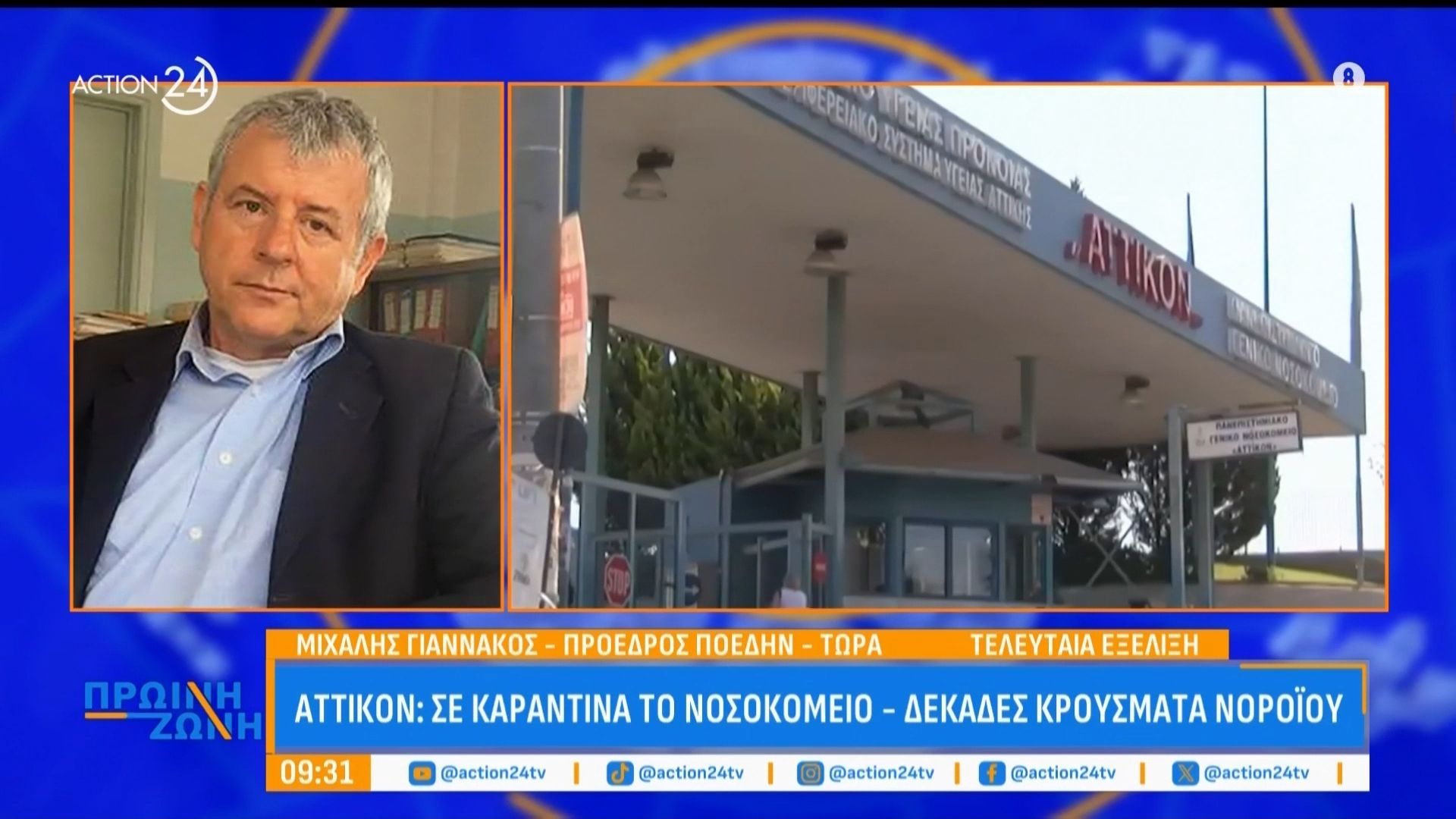 Αττικόν: Σε καραντίνα το νοσοκομείο – Δεκάδες κρούσματα νοροϊού