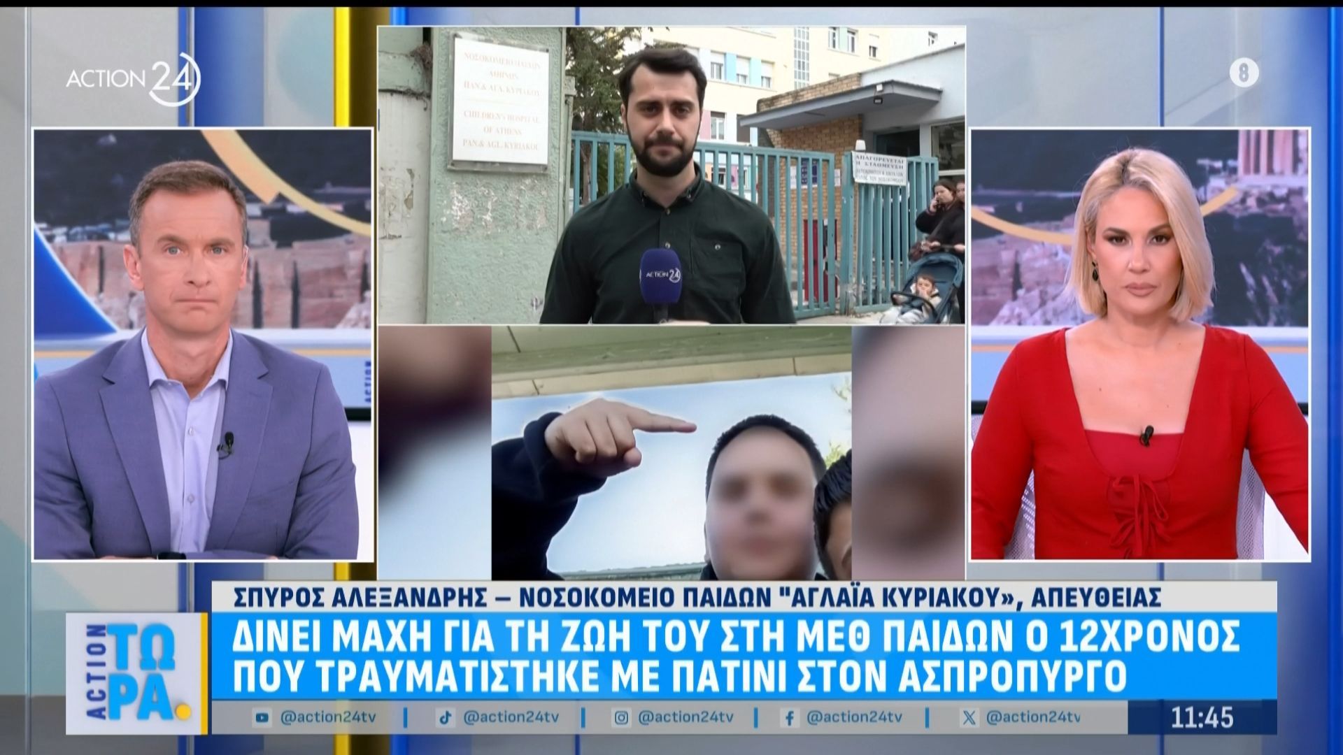 Δίνει μάχη για τη ζωή του στη ΜΕΘ Παίδων ο 12χρονος που τραυματίστηκε με το πατίνι