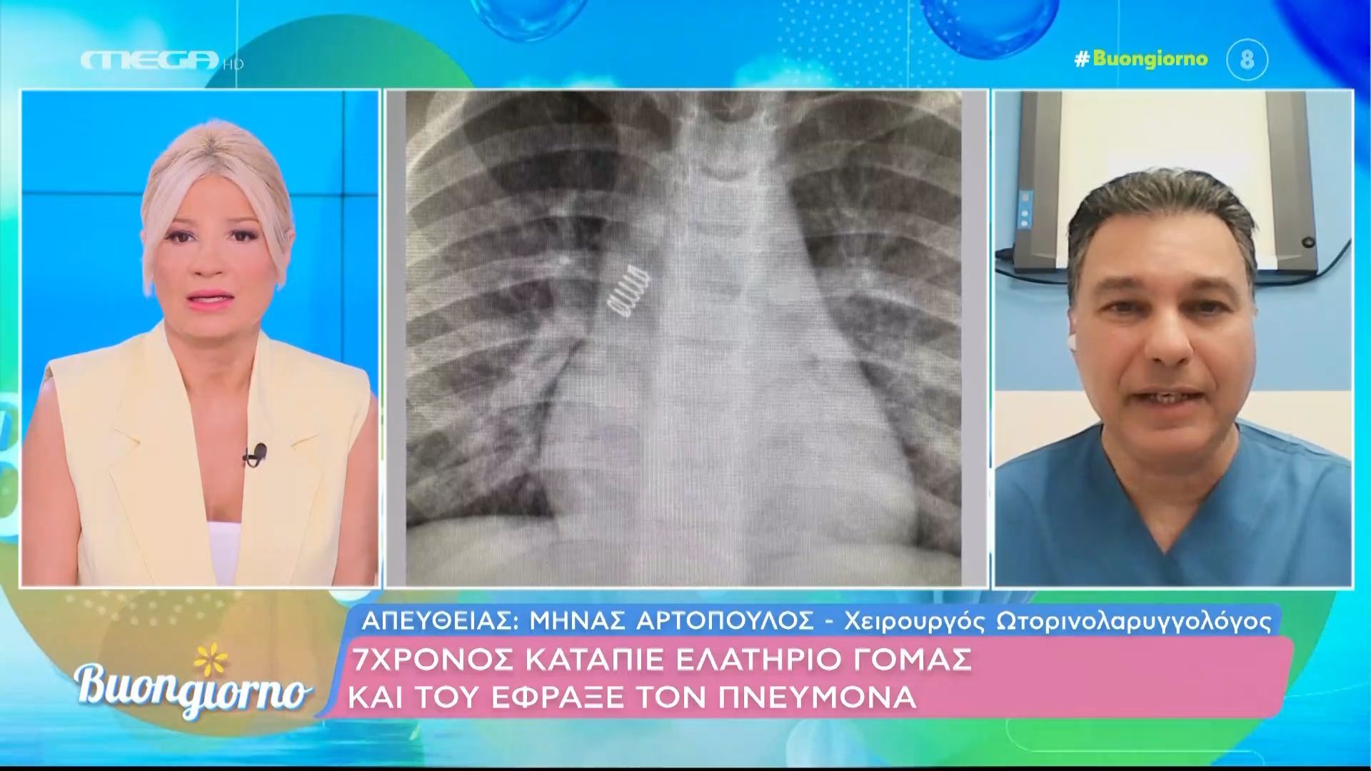 Επτάχρονος κατάπιε ελατήριο γόμας και του έφραξε τον πνεύμονα