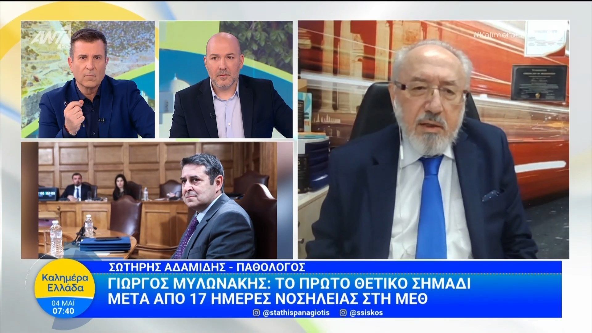 Γ. Μυλωνάκης: Το πρώτο θετικό σημάδι μετά από 17 μέρες νοσηλείας στη ΜΕΘ – Καλημέρα Ελλάδα – 04/05/2026