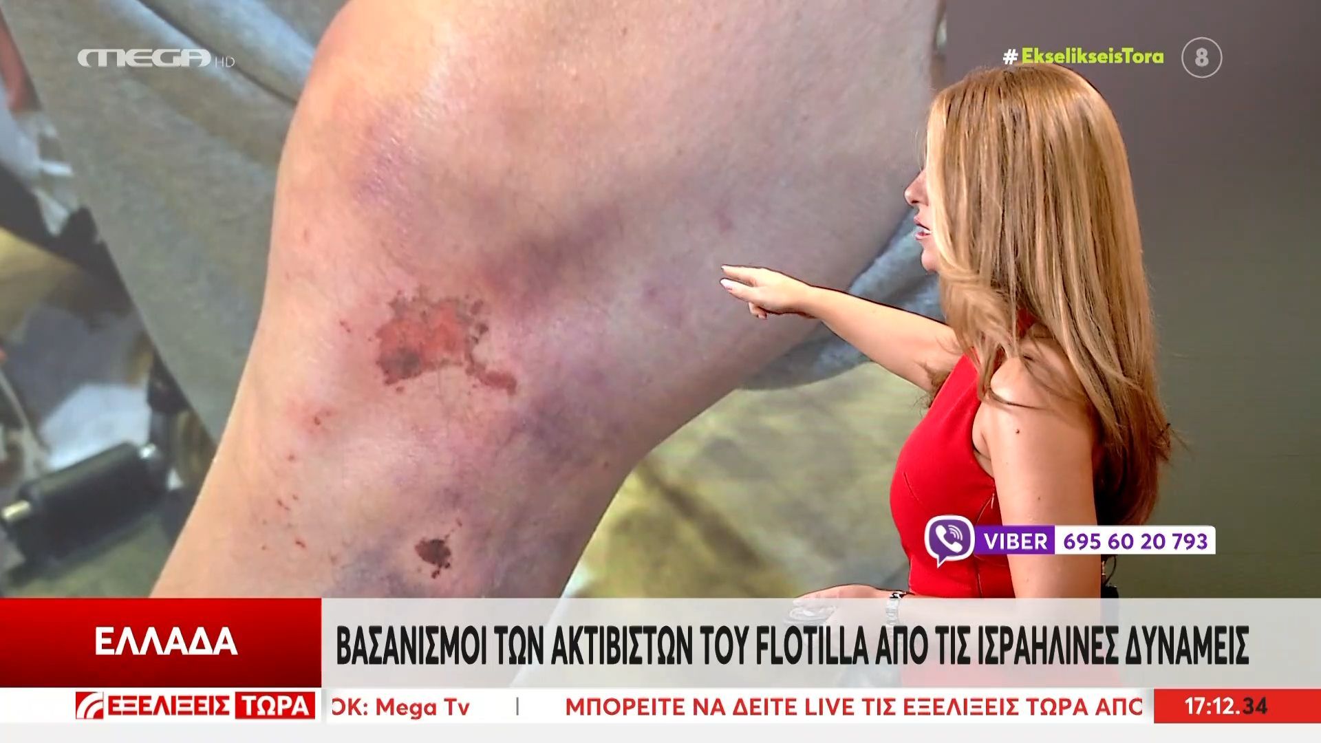 Γάζα: Βασανισμοί των ακτιβιστών του «Flotila» από τις ισραηλινές δυνάμεις