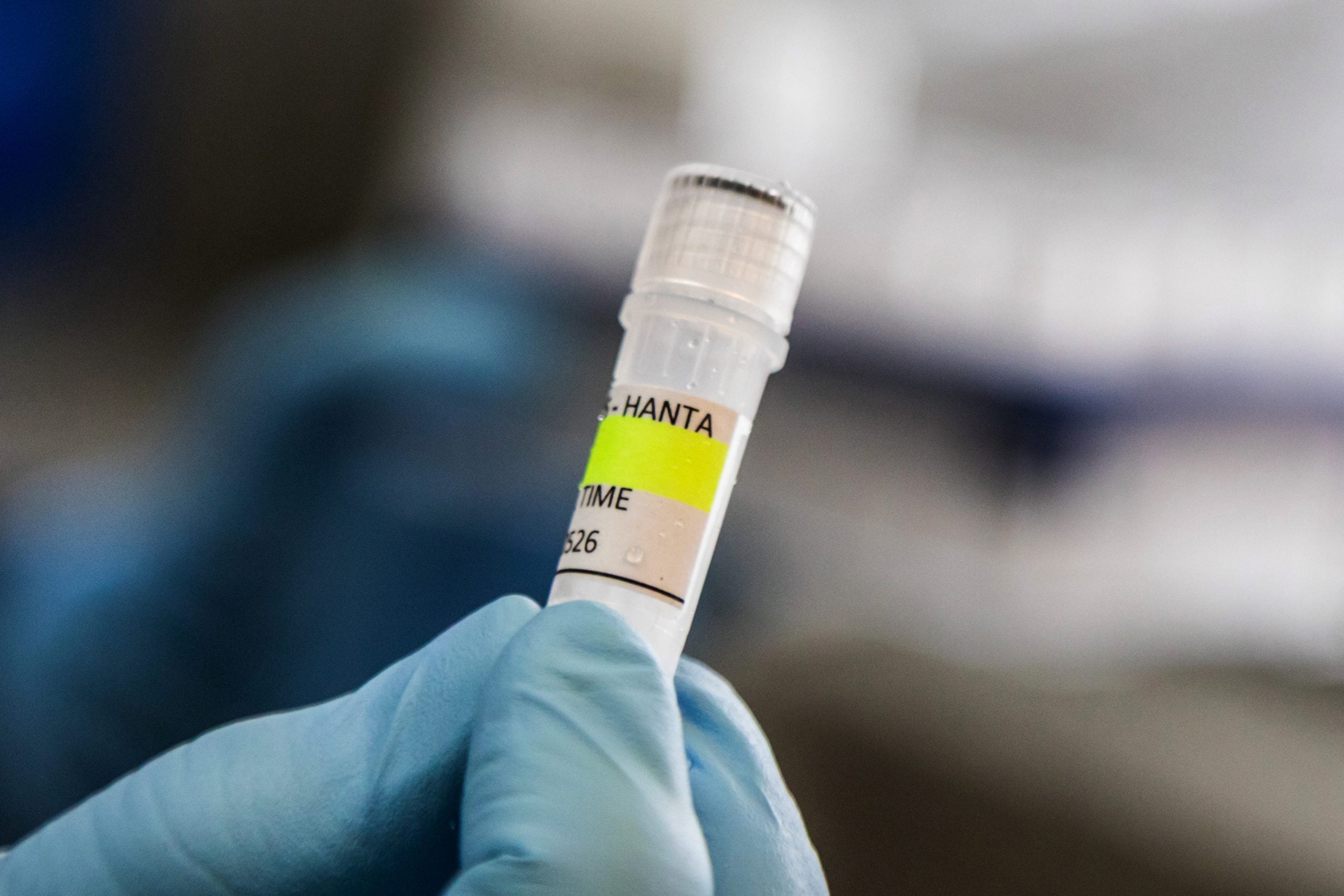 ΗΠΑ: Τα CDC παρακολουθούν 41 άτομα τις επόμενες εβδομάδες λόγω επαφών με κρούσματα χανταϊού