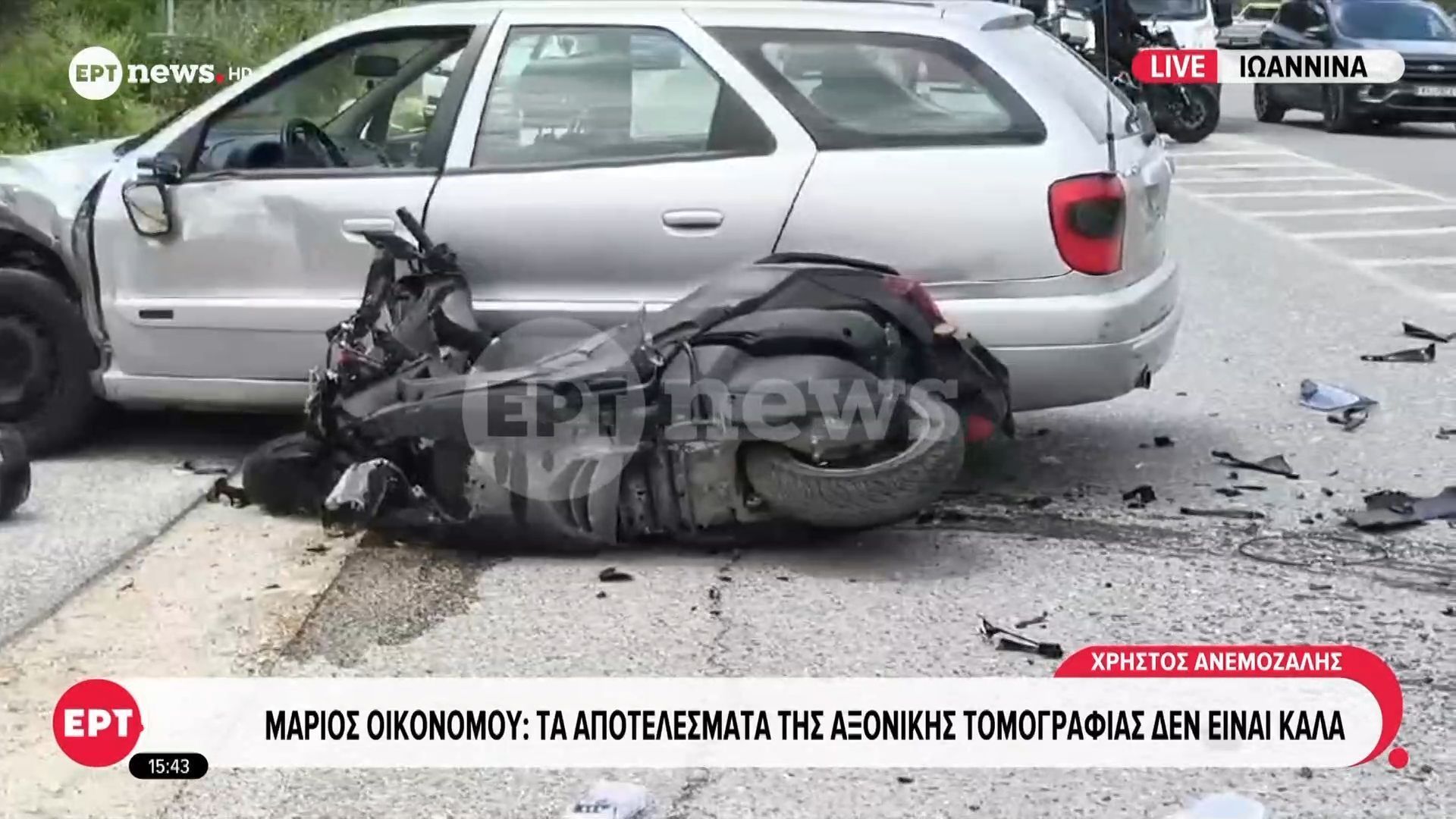 Μάριος Οικονόμου: Τα αποτελέσματα της αξονικής τομογραφίας δεν είναι καλά