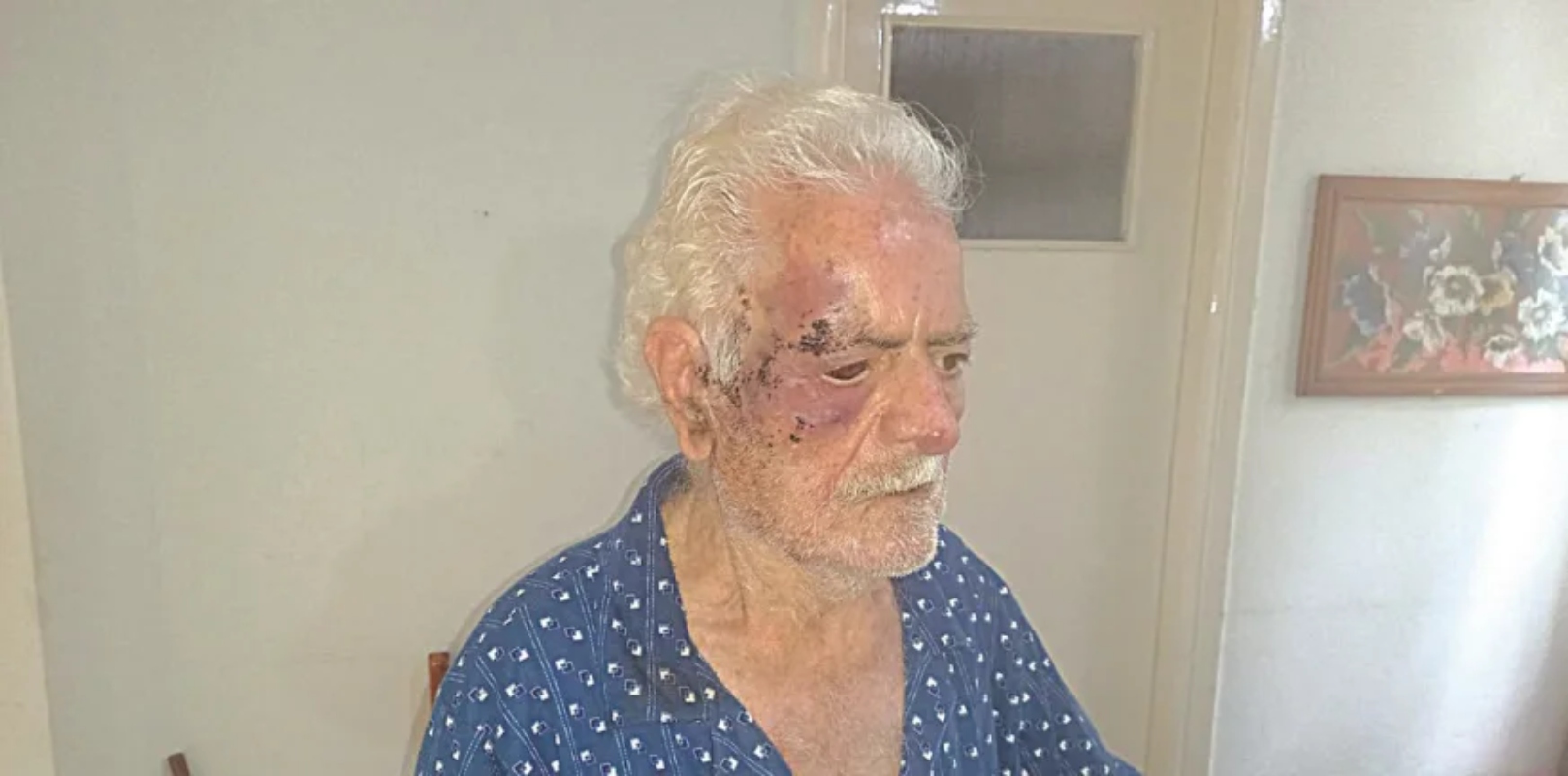 Πάτρα: Βίαιη ληστεία σε ηλικιωμένο ζευγάρι στο σπίτι τους – Τους κακοποίησαν βάναυσα 4 Ο 92χρονος