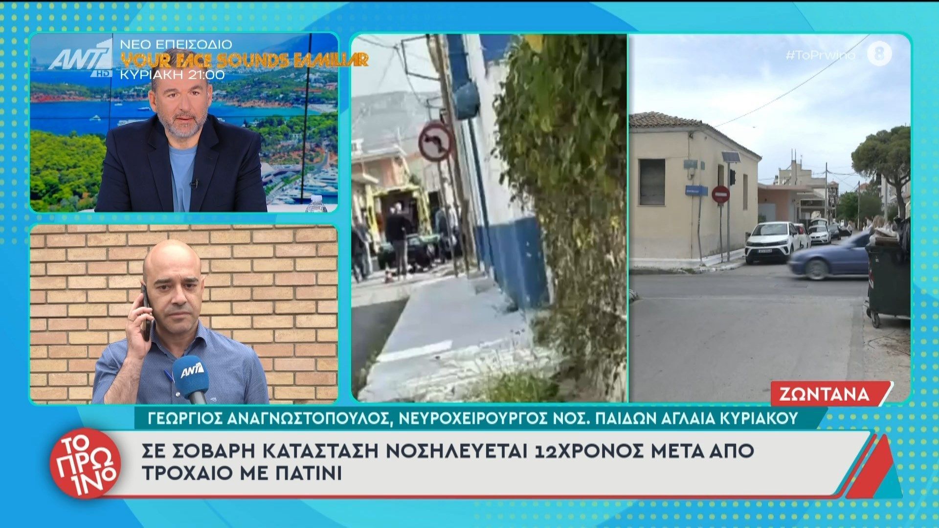 Σε σοβαρή κατάσταση νοσηλεύεται 12χρονος μετά από τροχαίο με πατίνι – Το Πρωινό – 08/05/2026