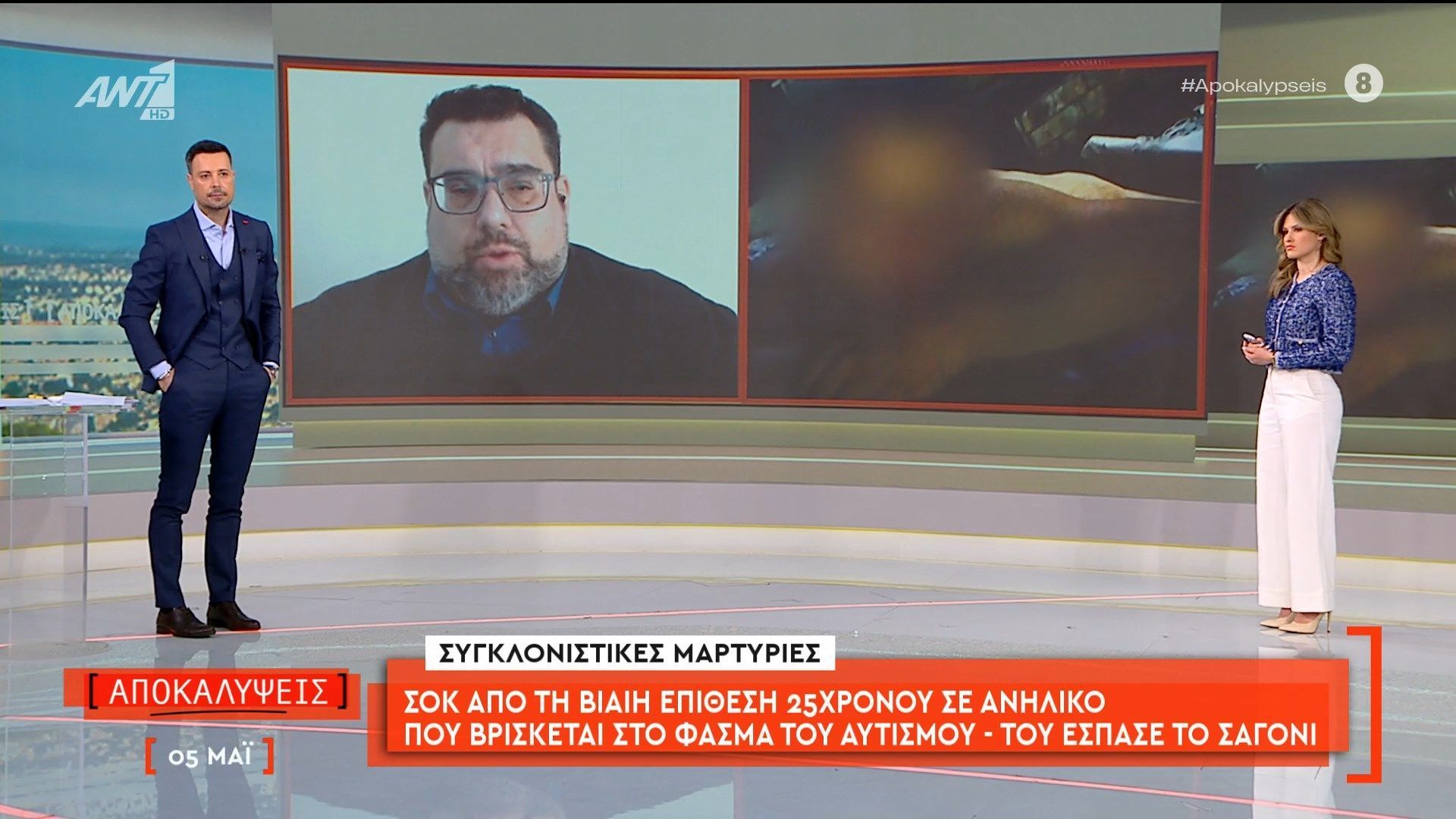 Σοκ από τη βίαιη επίθεση 25χρονου σε ανήλικο που βρίσκεται στο φάσμα του αυτισμού