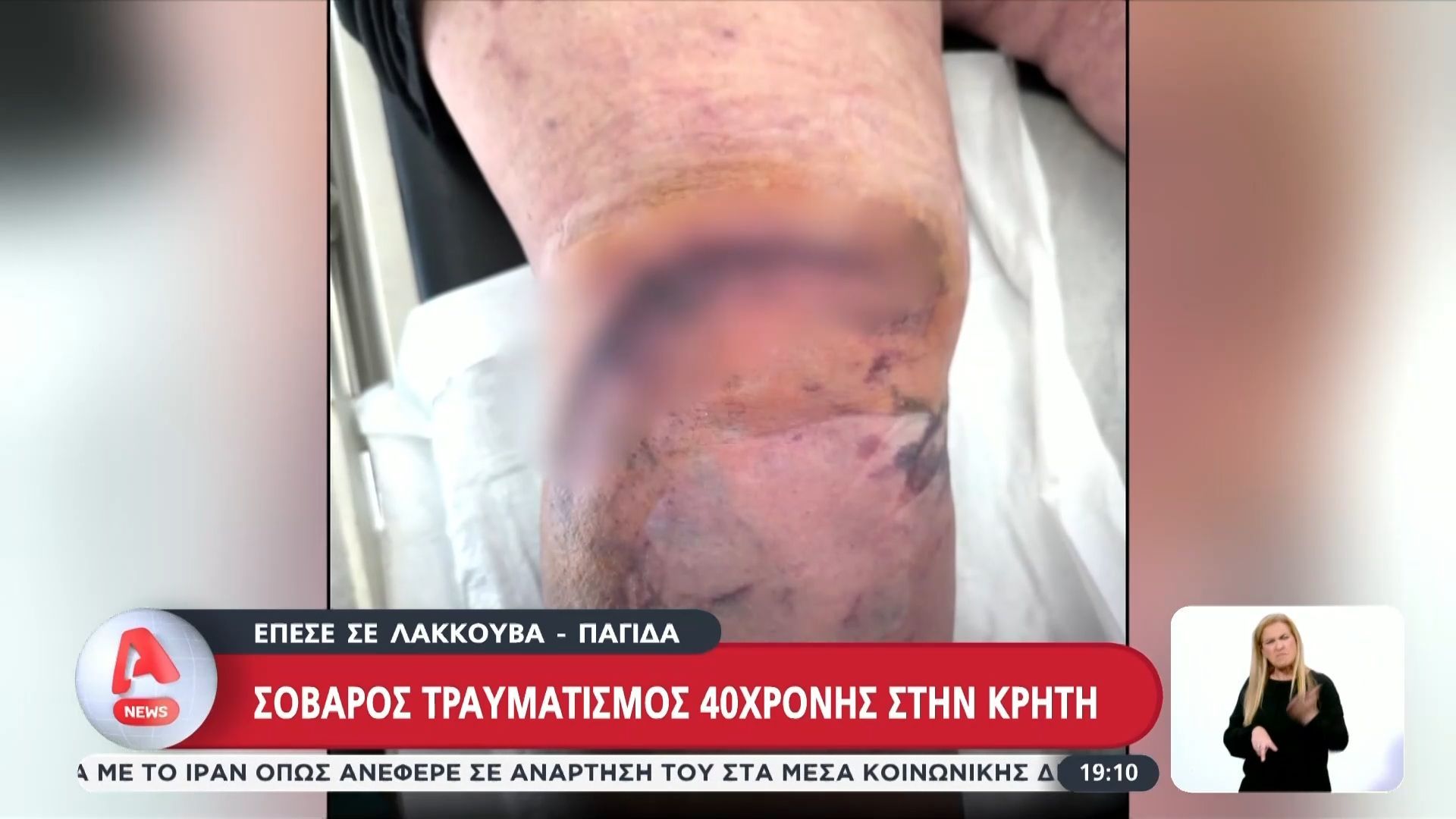 Σοκ στην Κρήτη με τον Τραυματισμό 40χρονης από Πτώση σε Λακούβα