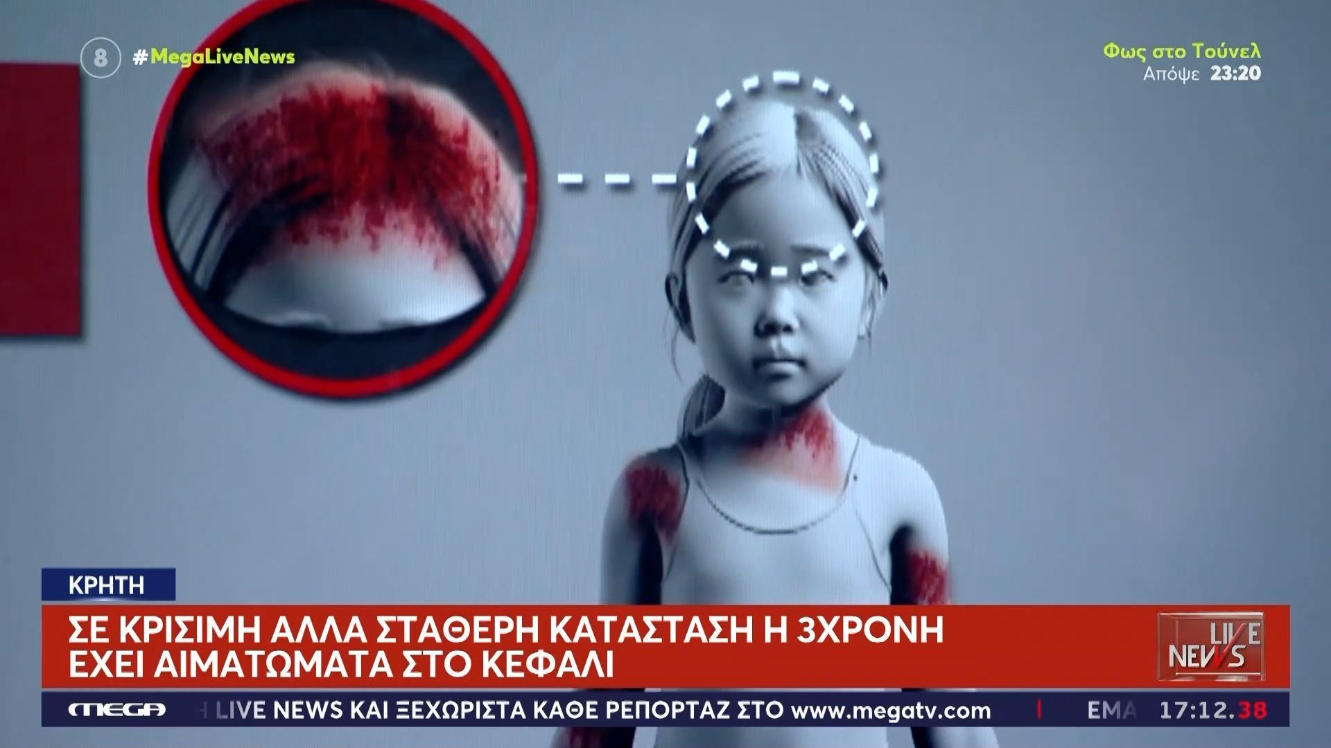 Σοκ στην Κρήτη: Σε κρίσιμη αλλά σταθερή κατάσταση η 3χρονη – Έχει αιματώματα στο κεφάλι