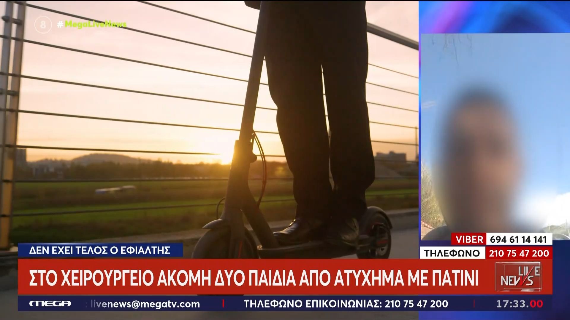 Στο χειρουργείο ακόμη δύο παιδιά από ατύχημα με πατίνι