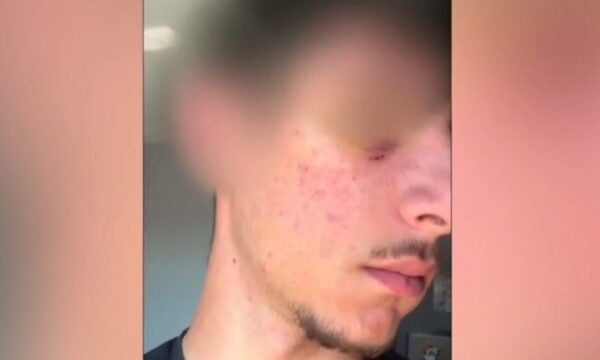 Τρίκαλα: Η μητέρα του 16χρονου για τον ξυλοδαρμό του – «Θα τον σκότωναν, κάποιοι επικροτούσαν τον δράστη»