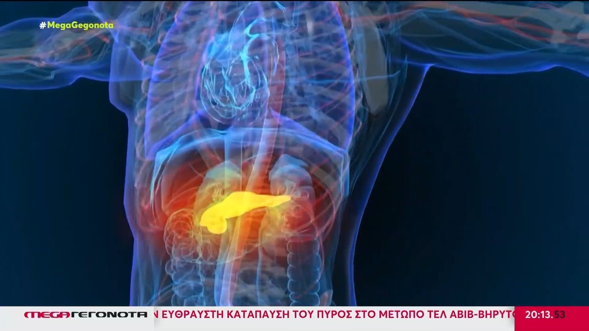 Ελπίδα κατά του καρκίνου του παγκρέατος από φάρμακο που περιορίζει τους όγκους