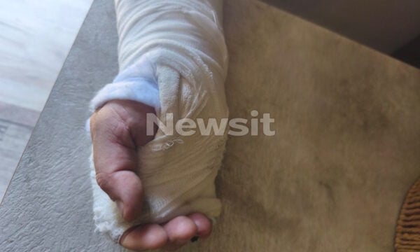 Νίκαια: Ο οδηγός απορριμματοφόρου που ξυλοκοπήθηκε από την παρέα Πακιστανών λέει «Ήμουν πεσμένος στο έδαφος και με κλοτσούσαν»