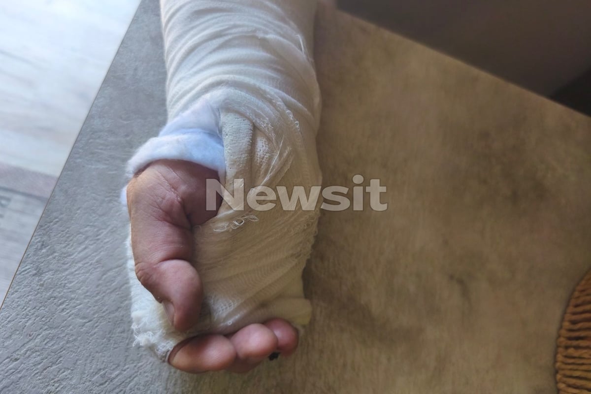 Νίκαια: Ο οδηγός απορριμματοφόρου που ξυλοκοπήθηκε από την παρέα Πακιστανών λέει «Ήμουν πεσμένος στο έδαφος και με κλοτσούσαν»