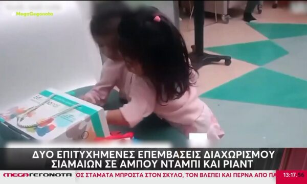 Δύο επιτυχημένες επεμβάσεις διαχωρισμού σιαμαίων σε Άμπου Ντάμπι & Ριάντ
