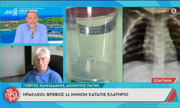Ηράκλειο: Βρέφος 11 μηνών κατάπιε ελατήριο – Το Πρωινό – 30/06/2026