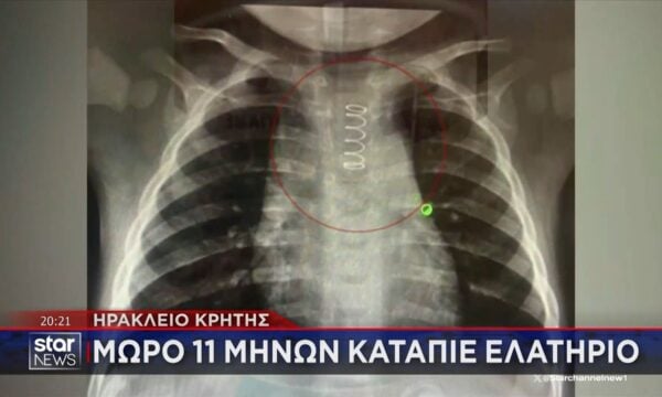 Κρήτη: Μωρό 11 μηνών κατάπιε ελατήριο