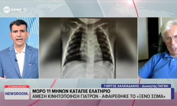 Μωρό 11 μηνών κατάπιε ελατήριο: Άμεση κινητοποίηση γιατρών – Αφαιρέθηκε το «ξένο σώμα»