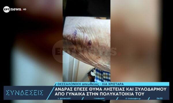 Θεσσαλονίκη: Άνδρας έπεσε θύμα ληστείας και ξυλοδαρμού από γυναίκα στην πολυκατοικία του