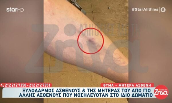 Θριάσιο: Έντονο επεισόδιο και ξυλοδαρμός ασθενούς και της μητέρας του από τον γιο άλλης ασθενούς που νοσηλευόταν στο δωμάτιο
