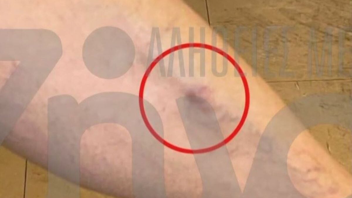 Θριάσιο: 38χρονος ασθενής καταγγέλλει ξυλοδαρμό από συνοδό άλλου ασθενούς μέσα στον θάλαμο νοσηλείας 1 Θριάσιο: 38χρονος ασθενής καταγγέλλει ξυλοδαρμό από συνοδό άλλου ασθενούς μέσα στον θάλαμο νοσηλείας