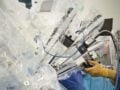 Πρώτη διηπειρωτική τηλεχειρουργική επέμβαση στην Ελλάδα, με τον ασθενή στην Αθήνα και τον χειρουργό στην Κίνα
