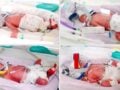 Αυστραλία: Γεννήθηκαν πανομοιότυπα τετράδυμα από φυσική σύλληψη – οι γονείς λένε «Οι καρδιές μας είναι γεμάτες ευγνωμοσύνη»