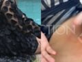 Τραγουδίστρια: Τη δάγκωσε χελώνα καρέτα – καρέτα – «Έπαθα κάταγμα προσπαθώντας να της ανοίξω το στόμα»