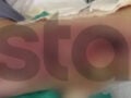 Θεσσαλονίκη: 20χρονη καταγγέλλει εγκαύματα γ’ βαθμού μετά από επέμβαση ρουτίνας – «Είχα γαντζωθεί στο κρεβάτι, έβραζαν τα πόδια μου»