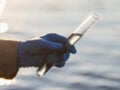 Βακτήριο Vibrio εξαπλώνεται στις ακτές της Ευρώπης: Οι κίνδυνοι και τα συμπτώματα