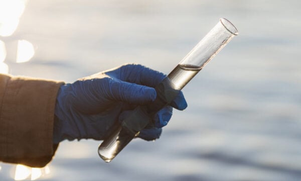 Βακτήριο Vibrio εξαπλώνεται στις ακτές της Ευρώπης: Οι κίνδυνοι και τα συμπτώματα