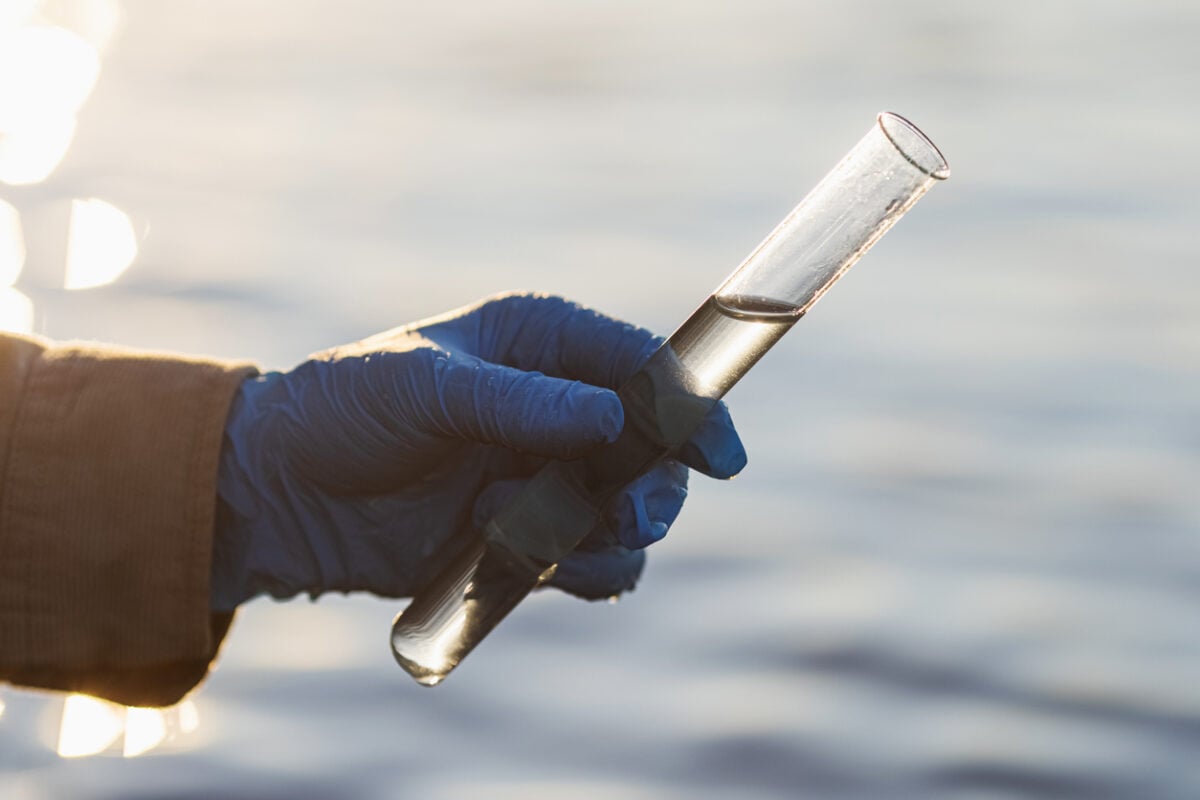 Βακτήριο Vibrio εξαπλώνεται στις ακτές της Ευρώπης: Οι κίνδυνοι και τα συμπτώματα