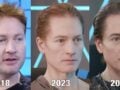 Bryan Johnson: Διαγνώστηκε με αυτοάνοσο ο biohacker που θέλει να ζήσει για πάντα – Τι είναι η ασθένεια που «τρώει το στομάχι»