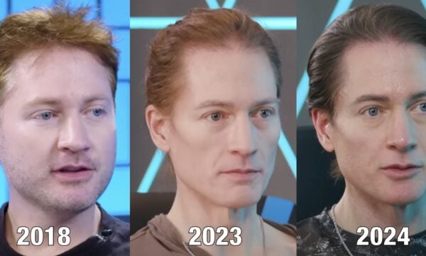 Bryan Johnson: Διαγνώστηκε με αυτοάνοσο ο biohacker που θέλει να ζήσει για πάντα – Τι είναι η ασθένεια που «τρώει το στομάχι»