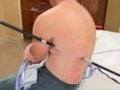 ΗΠΑ: Ορειβάτης περπάτησε 16 χιλιόμετρα για να σωθεί μετά από τραυματισμό από μπατόν πεζοπορίας