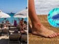 Σαρκοφάγο βακτήριο στις παραλίες λόγω καύσωνα: Πού εντοπίζεται και τι πρέπει να ξέρεις πριν βουτήξεις